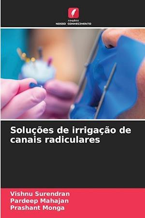 Soluções de irrigação de canais radiculares