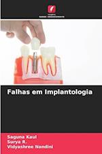 Falhas em Implantologia