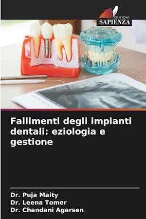 Fallimenti degli impianti dentali: eziologia e gestione