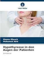 Hypothyreose in den Augen der Patienten