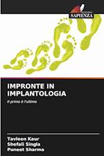 Impronte in Implantologia