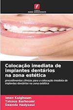 Colocação imediata de implantes dentários na zona estética