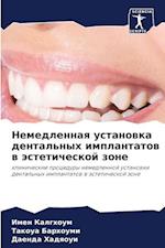 Nemedlennaq ustanowka dental'nyh implantatow w ästeticheskoj zone