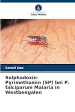 Sulphadoxin-Pyrimethamin (SP) bei P. falciparum Malaria in Westbengalen