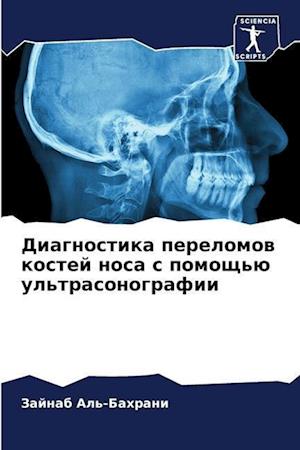 Diagnostika perelomow kostej nosa s pomosch'ü ul'trasonografii