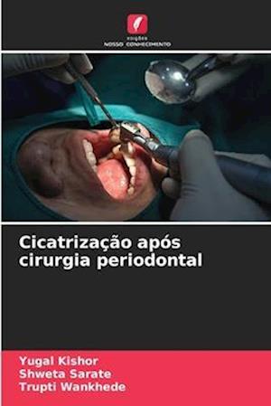 Cicatrização após cirurgia periodontal