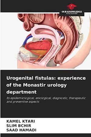 Urogenital fistulas: experience of the Monastir urology department