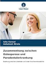 Zusammenhang zwischen Osteoporose und Parodontalerkrankung