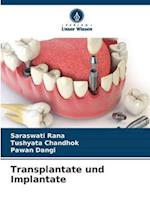 Transplantate und Implantate