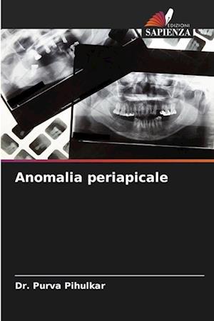 Anomalia periapicale