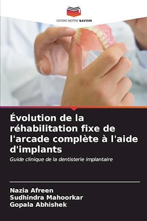 Évolution de la réhabilitation fixe de l'arcade complète à l'aide d'implants