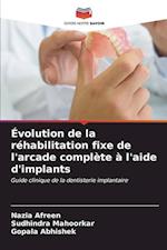 Évolution de la réhabilitation fixe de l'arcade complète à l'aide d'implants