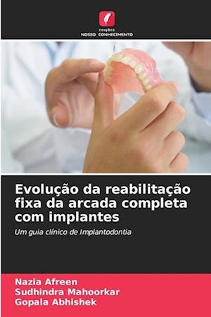 Evolução da reabilitação fixa da arcada completa com implantes