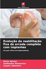 Evolução da reabilitação fixa da arcada completa com implantes