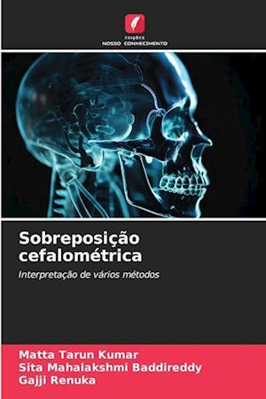 Sobreposição cefalométrica