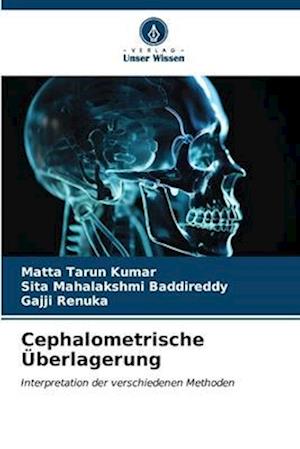 Cephalometrische Überlagerung