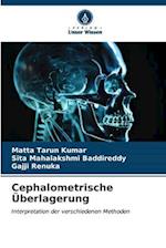 Cephalometrische Überlagerung