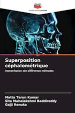 Superposition céphalométrique