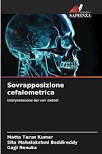 Sovrapposizione cefalometrica