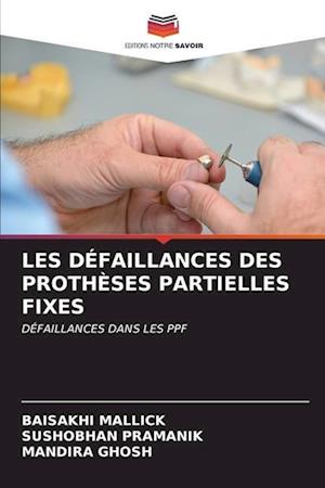 LES DÉFAILLANCES DES PROTHÈSES PARTIELLES FIXES