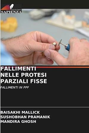 FALLIMENTI NELLE PROTESI PARZIALI FISSE