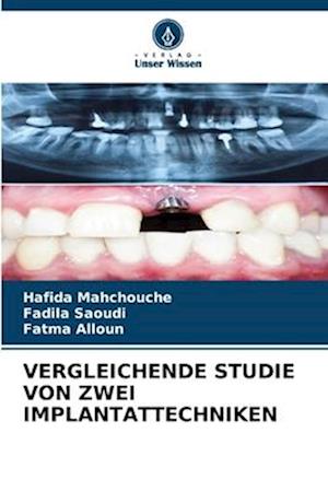 VERGLEICHENDE STUDIE VON ZWEI IMPLANTATTECHNIKEN