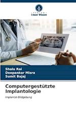 Computergestützte Implantologie