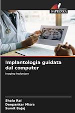 Implantologia guidata dal computer