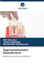 Supraimplantäre Einzelkrone