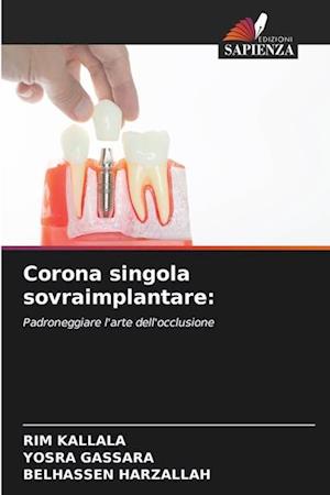 Corona singola sovraimplantare