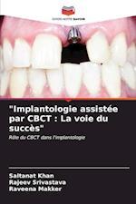 "Implantologie assistée par CBCT : La voie du succès"
