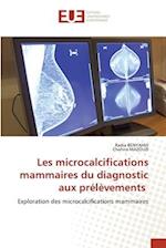 Les microcalcifications mammaires du diagnostic aux prélèvements