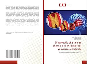 Diagnostic et prise en charge des Thromboses veineuses cérébrale