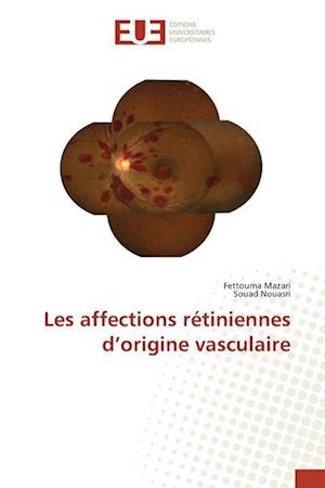 Les affections rétiniennes d¿origine vasculaire