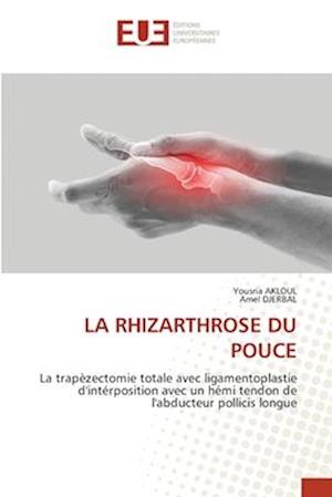 La Rhizarthrose Du Pouce