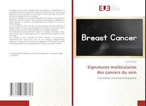 Signatures moléculaires des cancers du sein