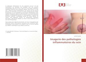 Imagerie des pathologies inflammatoires du sein