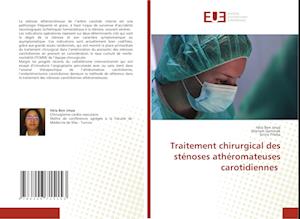 Traitement chirurgical des sténoses athéromateuses carotidiennes