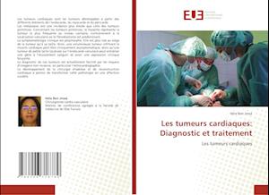 Les tumeurs cardiaques: Diagnostic et traitement