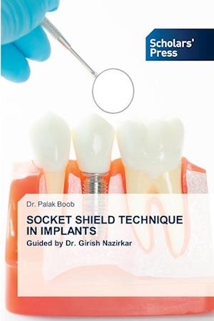 SOCKET SHIELD TECHNIQUE IN IMPLANTS