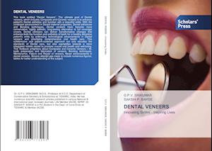 DENTAL VENEERS