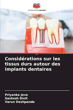 Considérations sur les tissus durs autour des implants dentaires