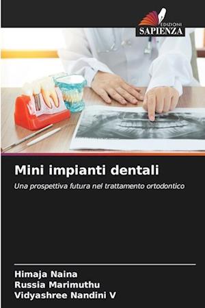 Mini impianti dentali