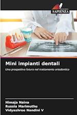 Mini impianti dentali