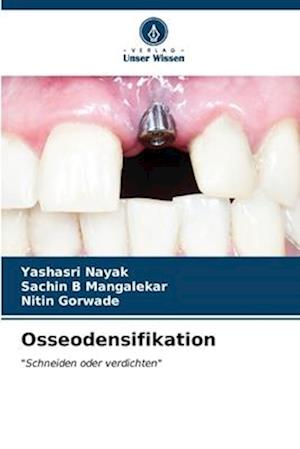 Osseodensifikation