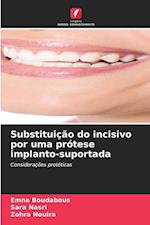 Substituição do incisivo por uma prótese implanto-suportada