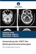 Anwendung der CBCT bei Kiefergelenkserkrankungen