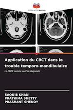 Application du CBCT dans le trouble temporo-mandibulaire