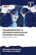 Tradicionnaq i laparoskopicheskaq holecistäktomiq