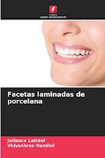 Facetas laminadas de porcelana